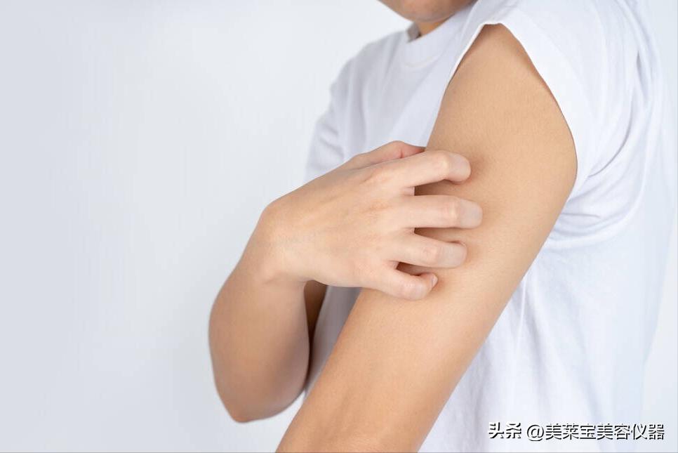 皮肤过敏敏感要怎么修复,皮肤敏感过敏