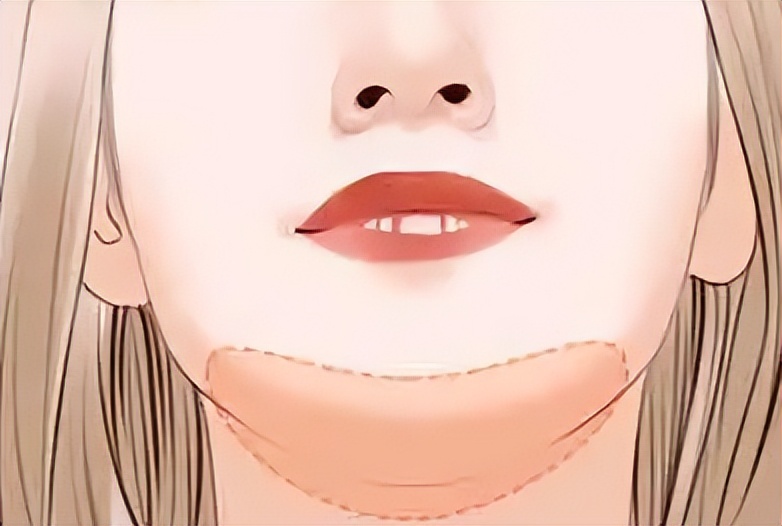 韦敏吸脂,九院整形科医生韦敏