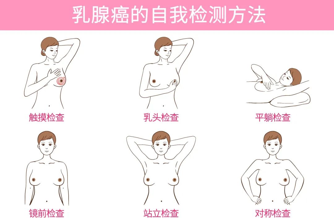 20岁得乳腺癌的治愈的几率,20岁得了乳腺癌是什么原因