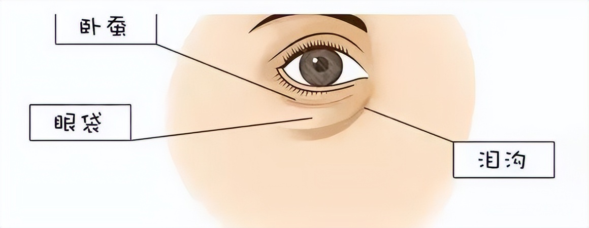 钱袋可以有，眼袋真不能有！