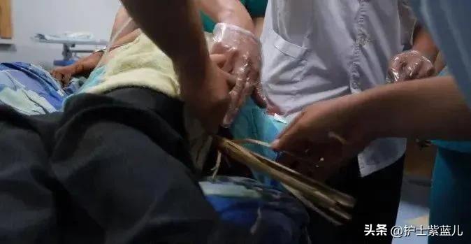 老人从高处跌落昏迷,老人不慎从台阶摔下躺在地上