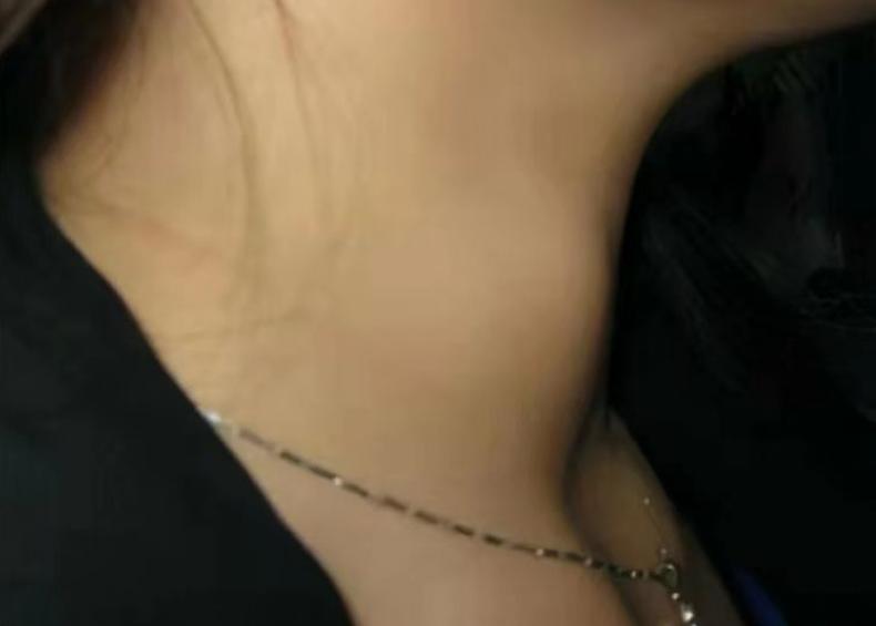 熬夜对甲状腺结节有影响吗,甲状腺结节的两大雷区有哪些