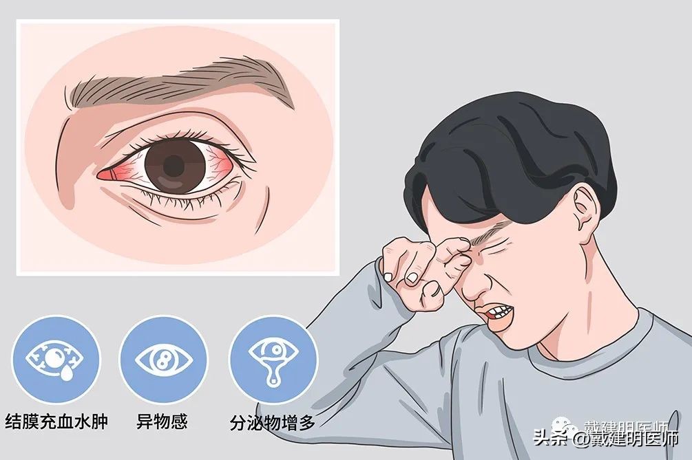红眼病真的看一眼就能传染吗,红眼病一看就传染吗
