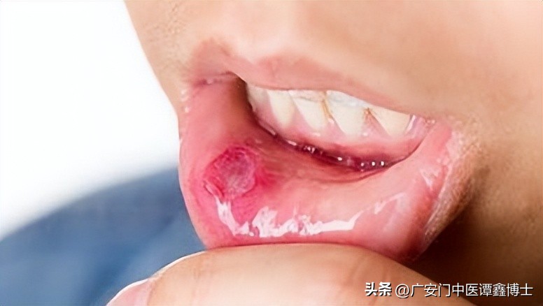 嘴角癌症早期的8个症状,嘴巴有四种症状会怎样