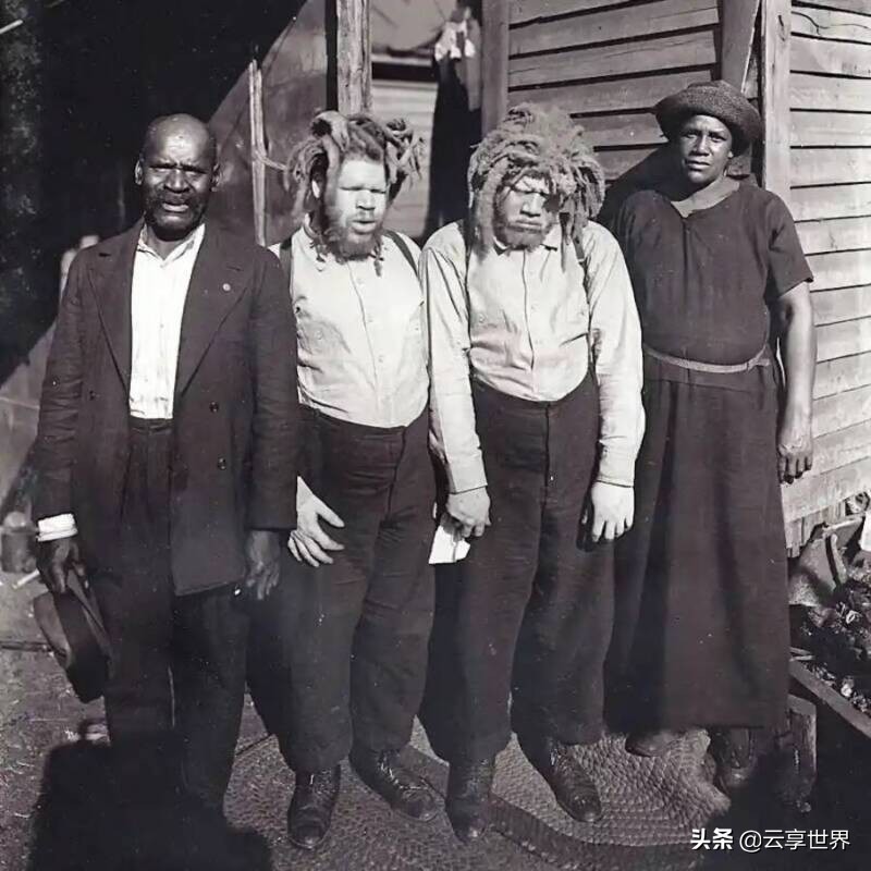 被歧视的异类群体，牟取暴利的工具，9位怪胎表演者的悲惨内幕