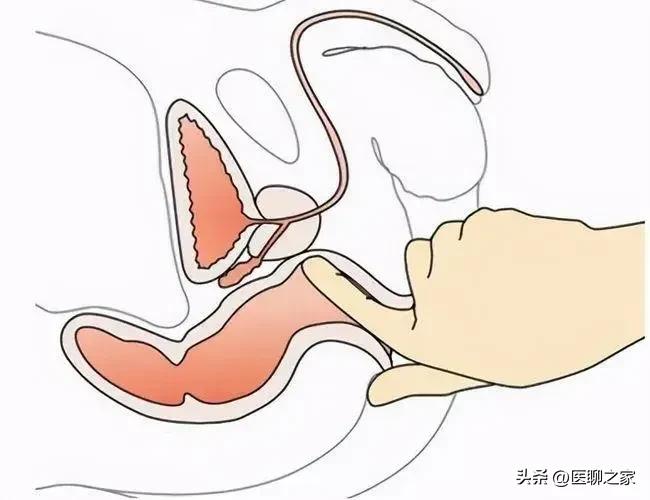 这七大肿瘤筛查方法请牢记，以防被不良体检中心忽悠！