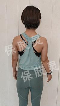 颈椎间盘突出压迫桡神经怎么恢复,颈椎间盘突出压迫手指麻怎么治疗