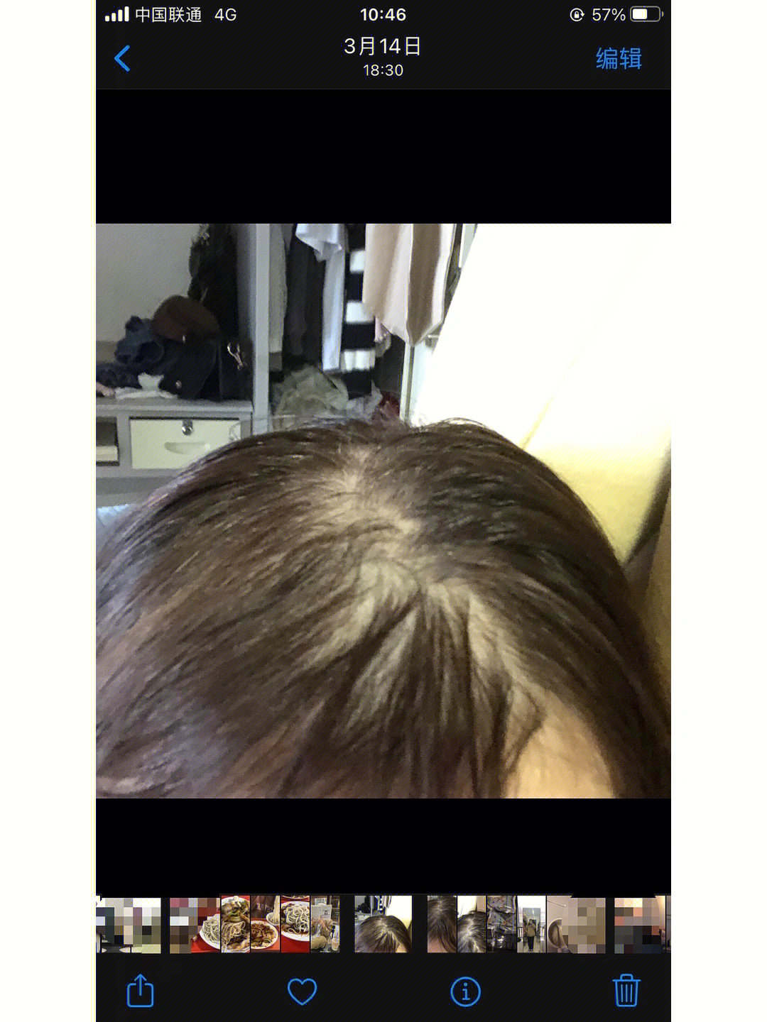 产后防脱发的洗发水有哪些,产后防脱发洗发水真实有效