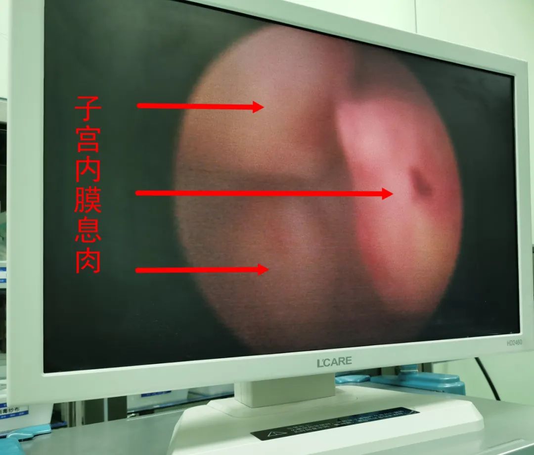 这个病，困扰了栖霞陈女士一年多