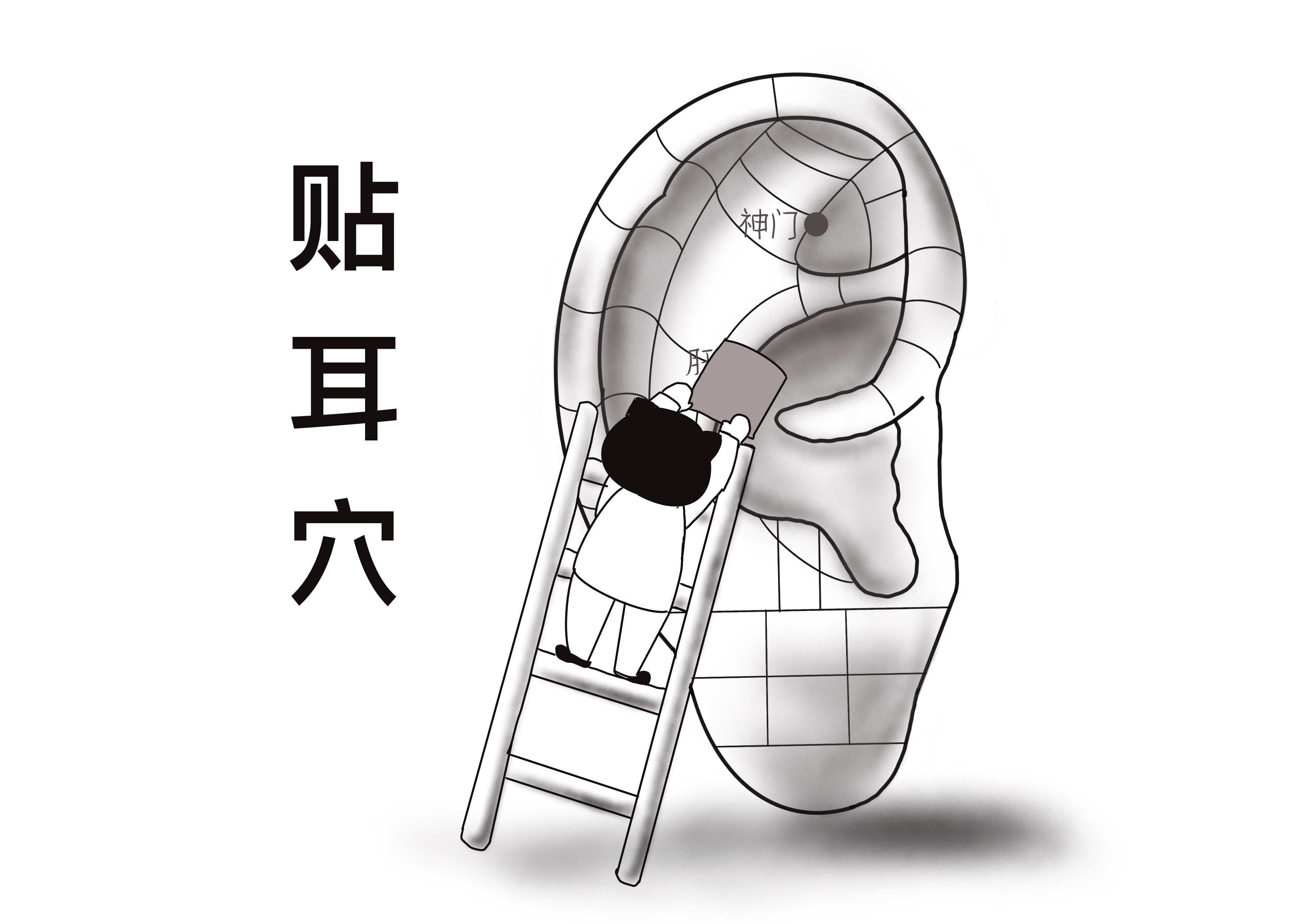 失眠便秘中医辨证治疗,失眠易怒便秘穴位