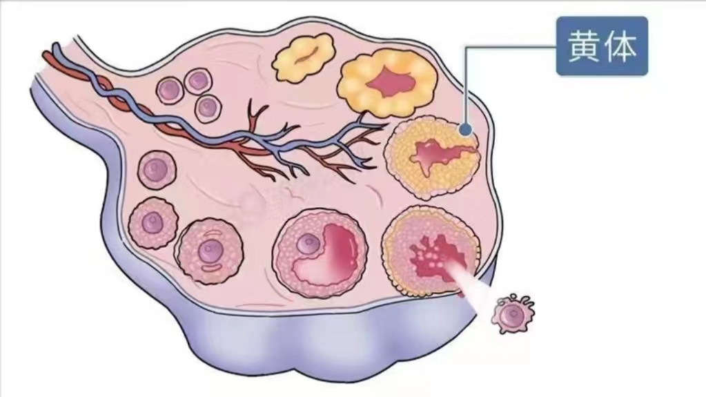 同房后酿成的悲剧:黄体破裂，夫妻生活不是打仗，要适度
