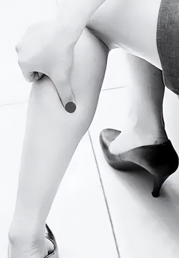 静脉曲张蜘蛛网,治疗蜘蛛网状静脉曲张小妙招