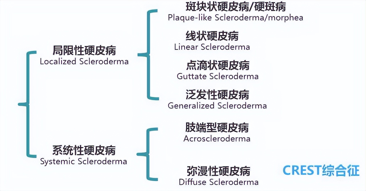 硬皮病分型治疗,硬皮病分为几种类型
