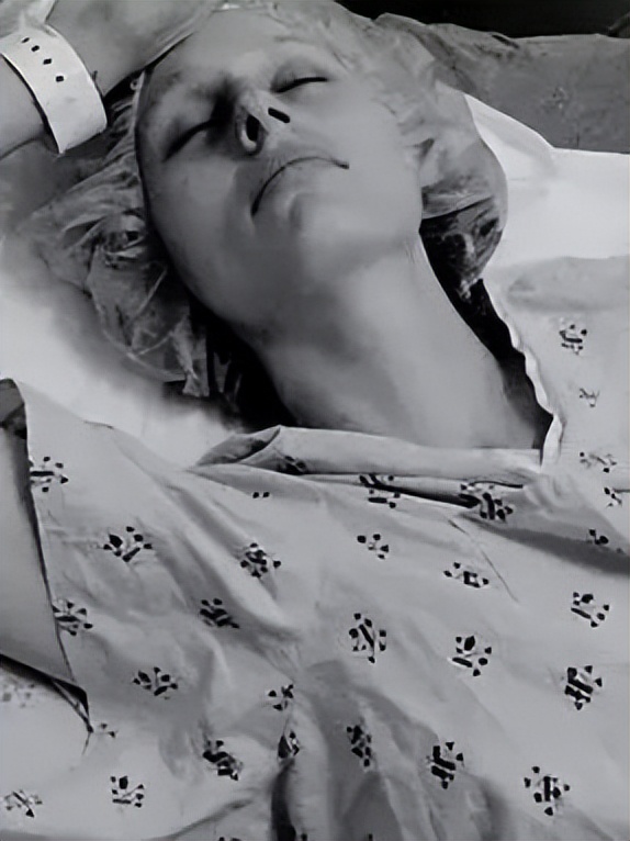 超模用卫生棉条感染截肢励志,一名超模因卫生棉截肢