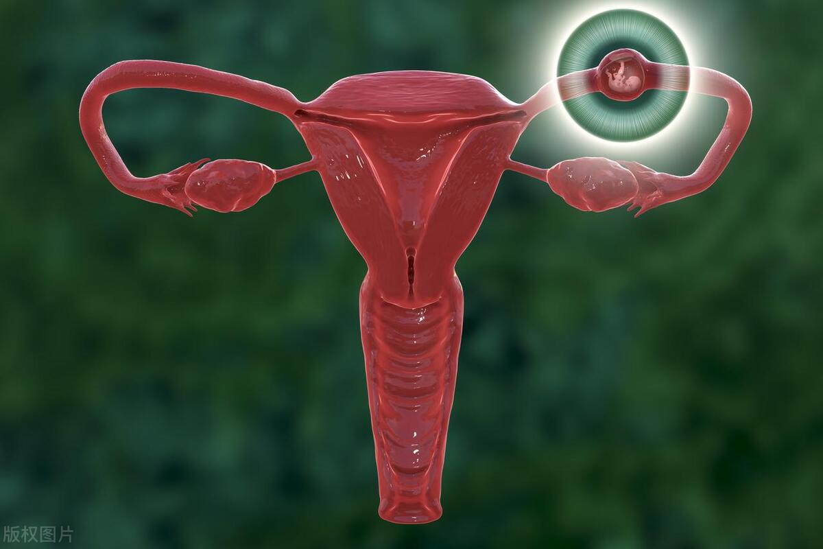 异常出血不干净是什么原因,不知道是月经还是异常出血怎么办