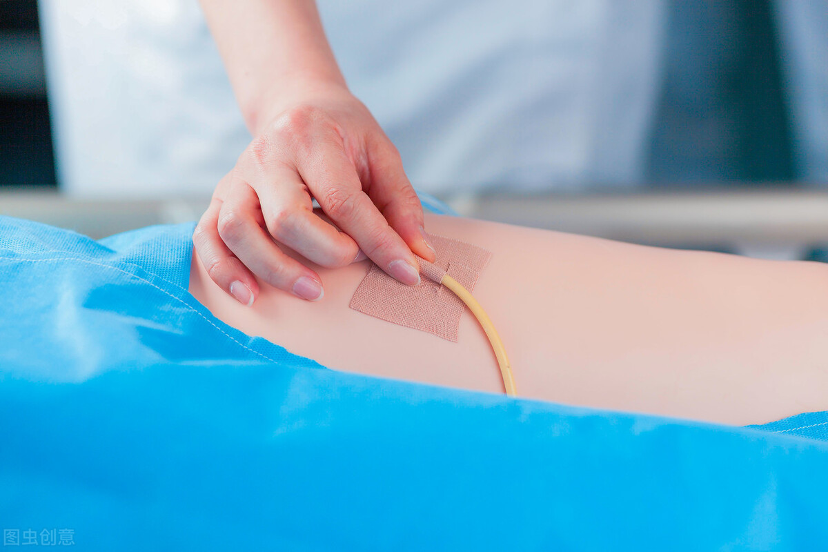 什么情况下胃管会脱落,胃管为啥脱出15厘米就要拔出来