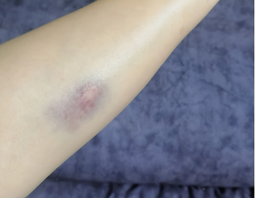 筋膜枪按头部有坏处吗,用筋膜枪对身体有危害吗