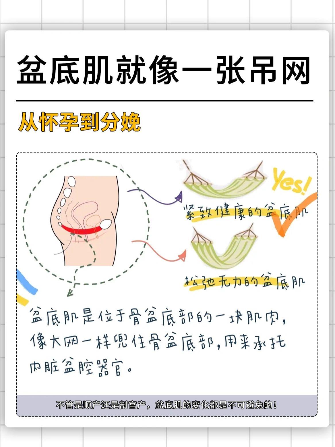 产后漏尿最快恢复盆底肌办法,产后盆底肌恢复的正确动作