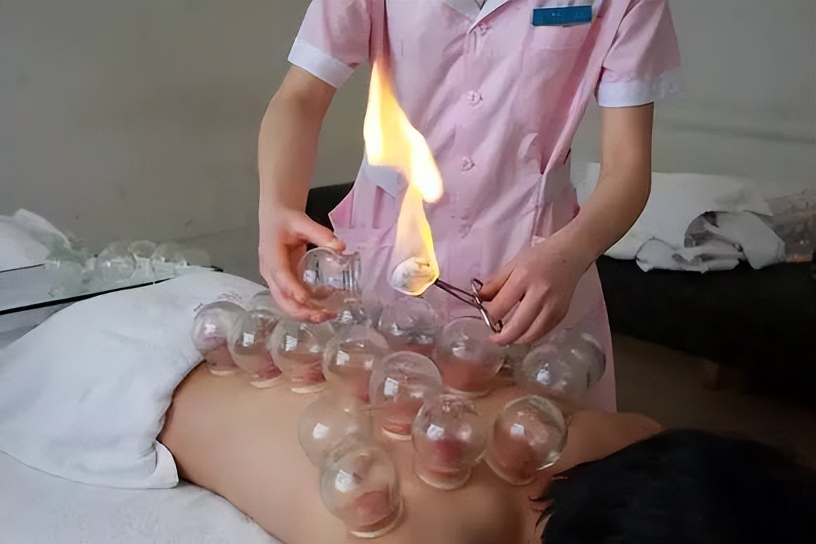 火罐里有水珠怎么回事,火罐拔出水珠是怎么回事