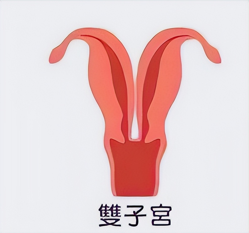 七种子宫形状，你了解过吗？