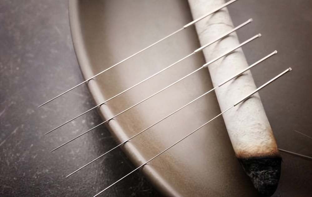 刺络拔罐联合常规针刺治疗神经根型颈椎病如何治疗?疗效如何?