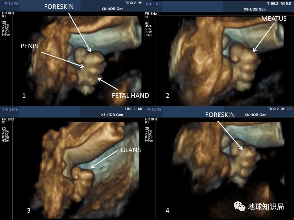 *慰自**太多，会变短么|地球知识局