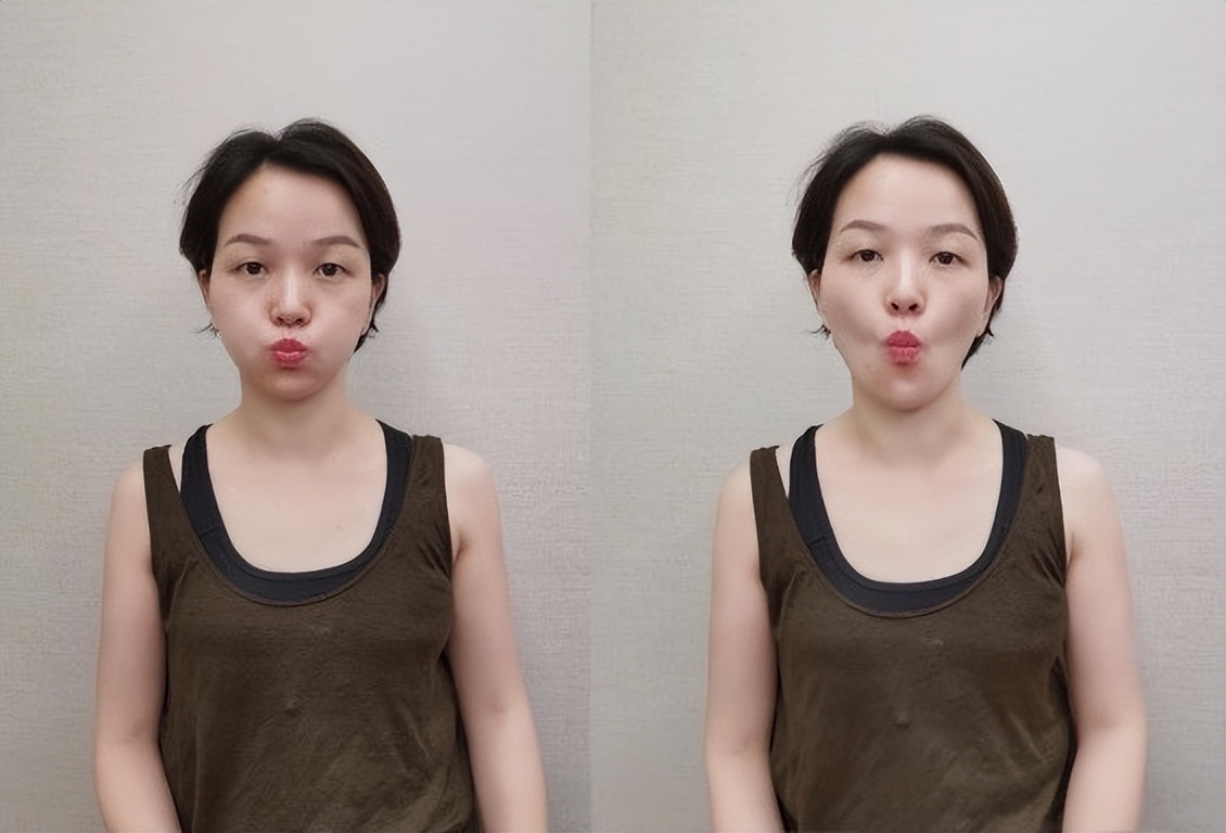 显老的罪魁祸首是什么,显老除了法令纹还有什么纹