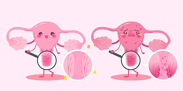 姨妈走了又来了吃什么药,姨妈走了又来怎么回事