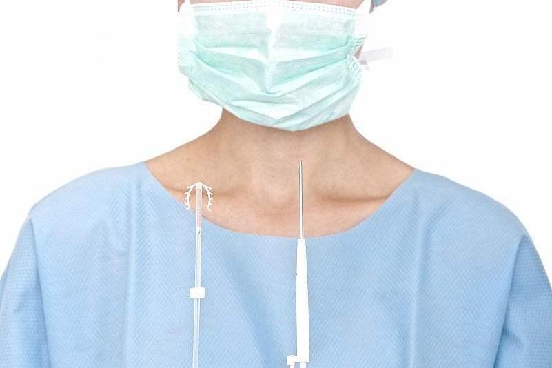 女人上环什么流程,女人上环流程