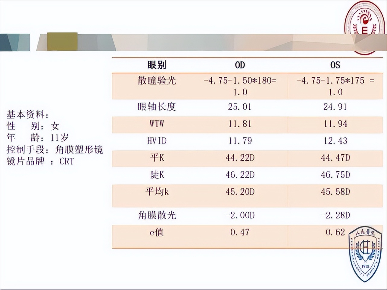 王凯角膜塑形镜原理,王凯医生塑形镜
