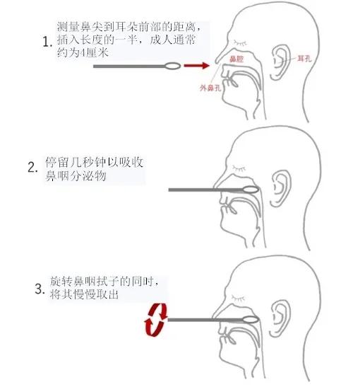 口咽、鼻咽拭子采集标准