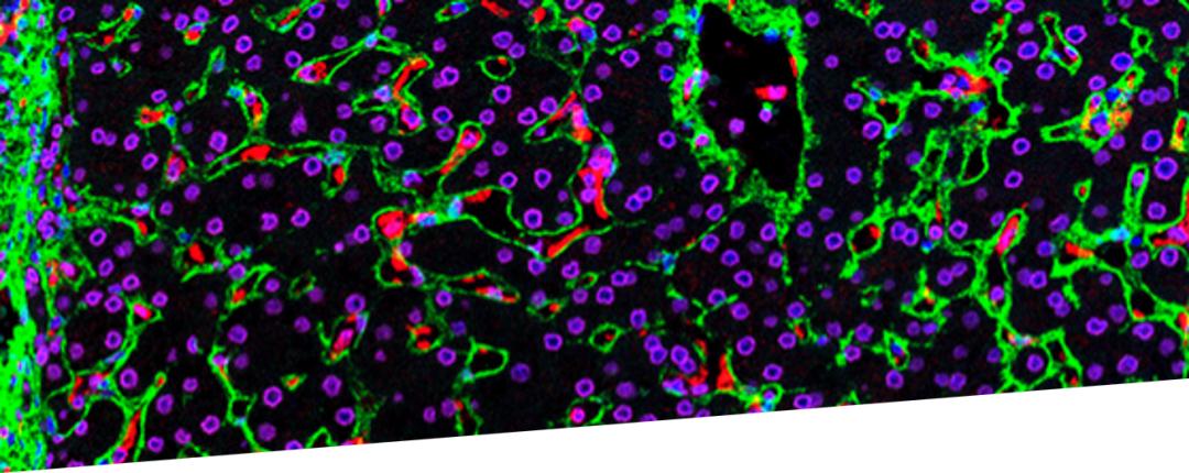 多重组化助力癌症研究及临床应用转化新进展（含mIHC抗体验证列表