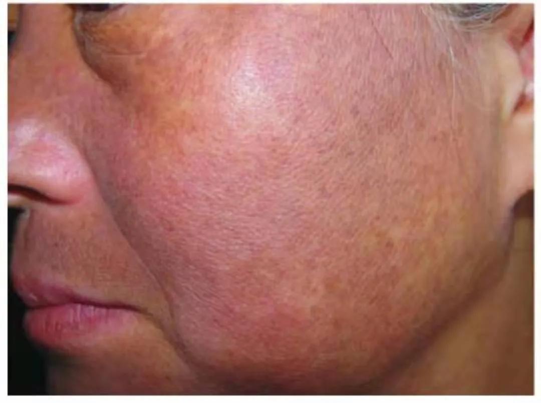 感觉化妆品越用脸反而有点黑,用很多护肤品皮肤还是很差