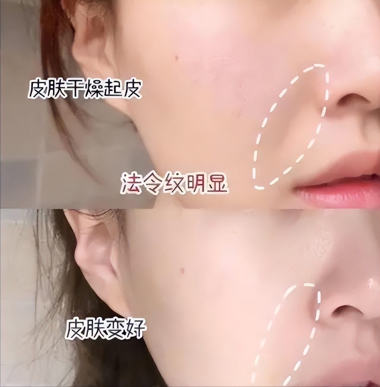 坚持用精华液和不用精华液的区别,精华跟平时用的精华液有什么不同