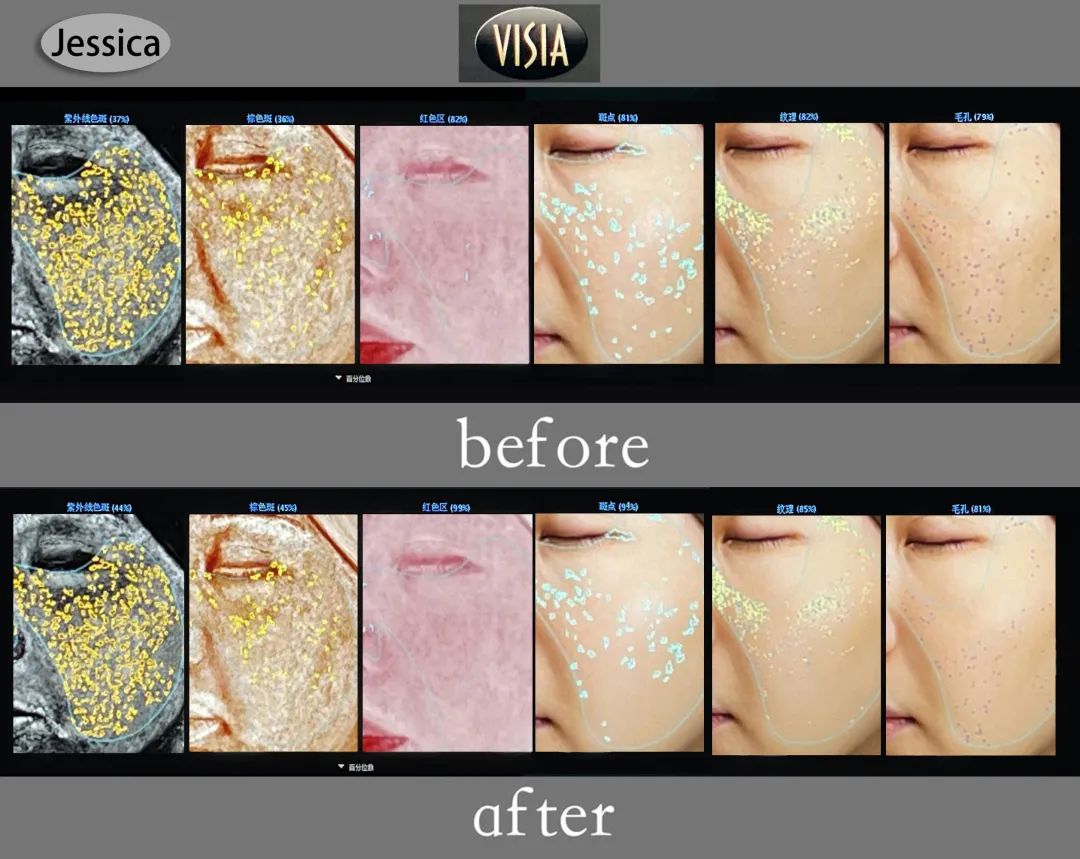 美肌试颜室‖直播见证，4周院线护肤的逆袭之路