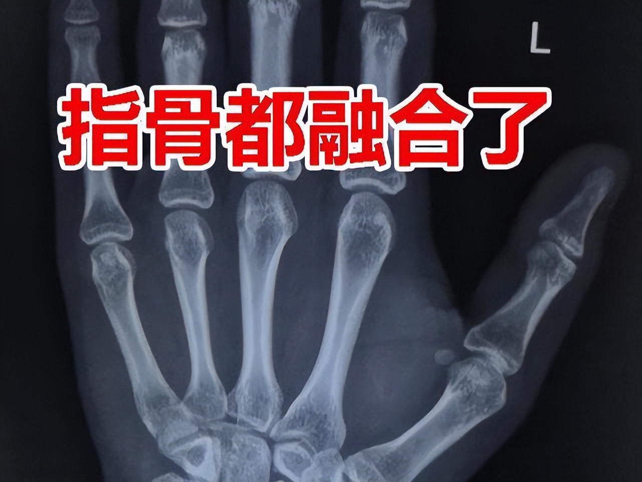 男生17岁身高182还能长吗,遗传身高168后天还能长高多少男生