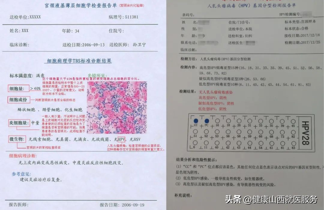 *裤内**上出现这东西,可能是宫颈癌前兆!千万别拖,尽早做两个检查