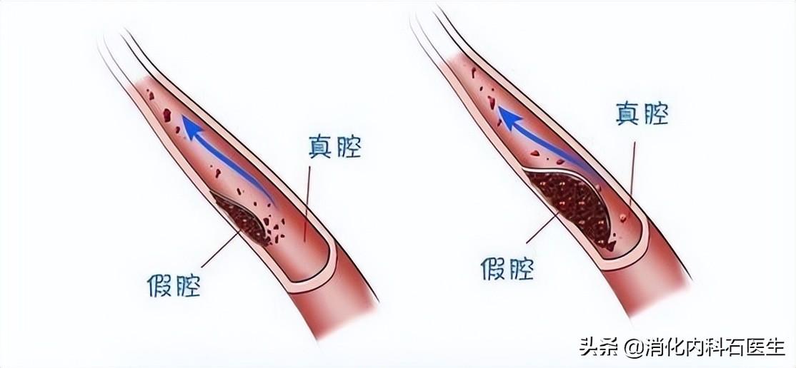 老人腰痛呼吸不通畅怎么办,90岁老人腰疼厉害住院治疗