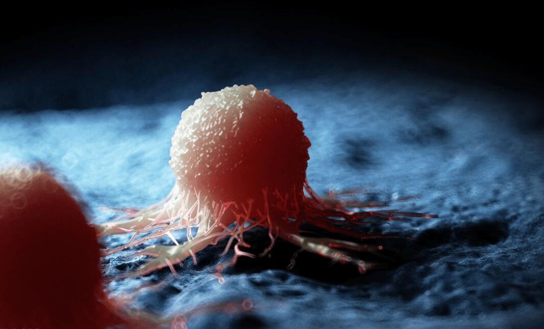 癌症是基因注定的，躲也躲不掉？父母的这5种癌，可能遗传下一代