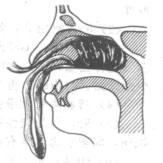 科普一下鼻出血如何止血,鼻出血健康科普