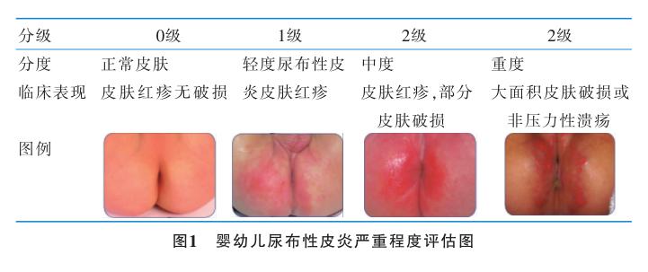 宝宝红屁股快速有效的治疗方法,小孩红屁股用什么药