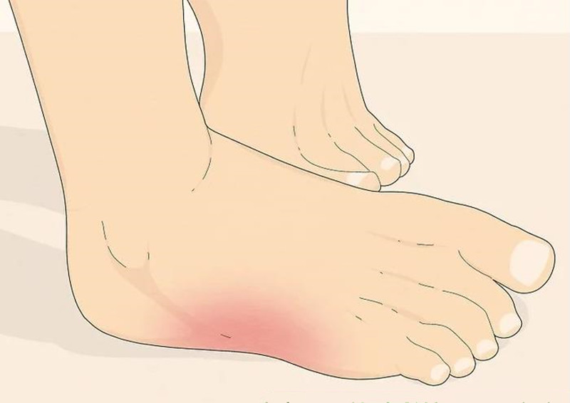 脚麻木是神经在恢复吗,脚发麻痛是什么病征兆怎么解决