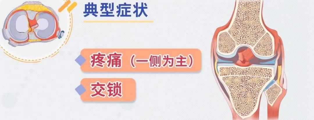 膝盖内侧肿痛是半月板损伤吗,膝盖酸软卡卡的响是什么情况