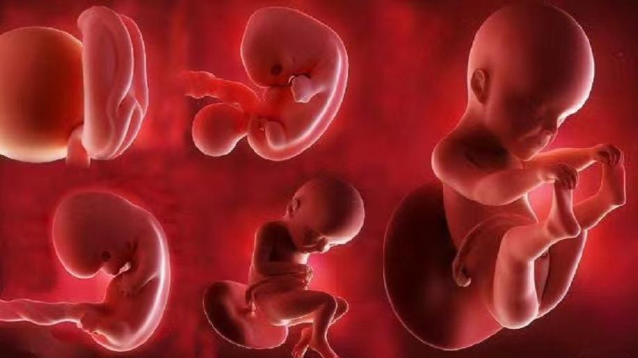 印度女子产下罕见胎中胎,胎中胎真实案例印度