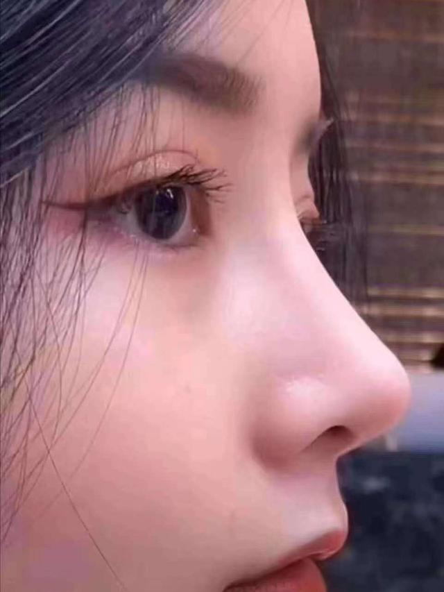 鼻子底子不好做哪款隆鼻,八大处医生隆鼻风格各有什么区别