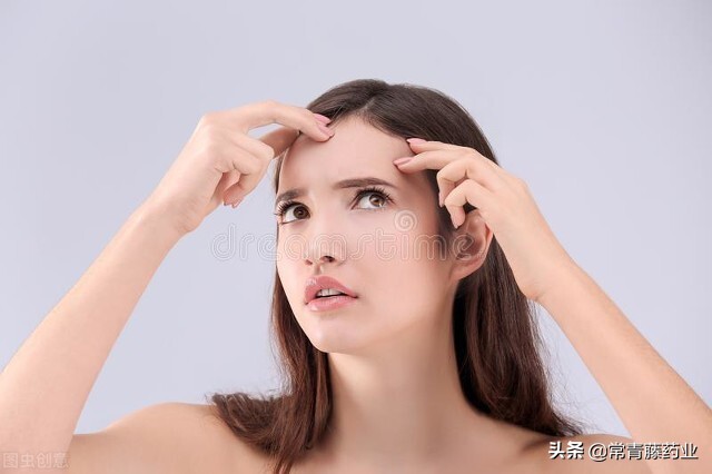 你有痘痘困扰你吗,你有被皮肤问题困扰过吗