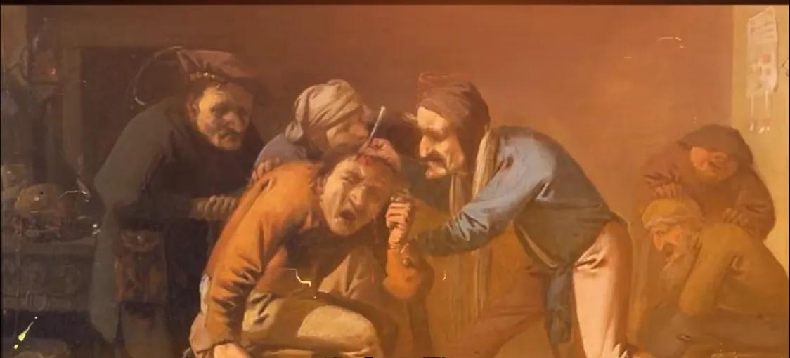 古代医学荒谬,古代西医有多荒唐