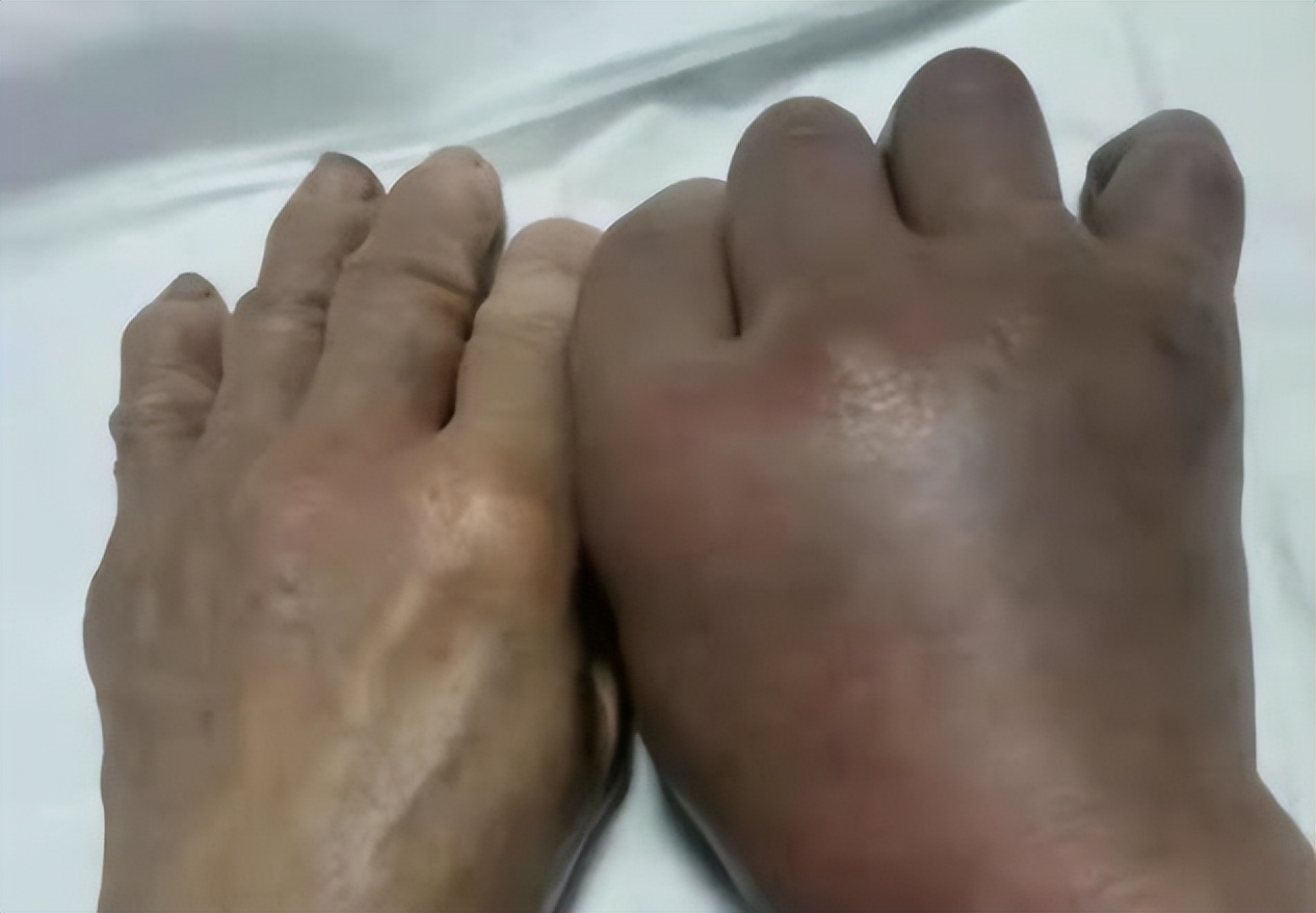 丛林探险美食大全,真正的丛林美食有哪些