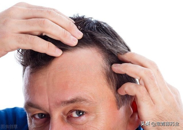 米诺地尔头痒怎么解决 (米诺地尔出现皮疹了怎么办)
