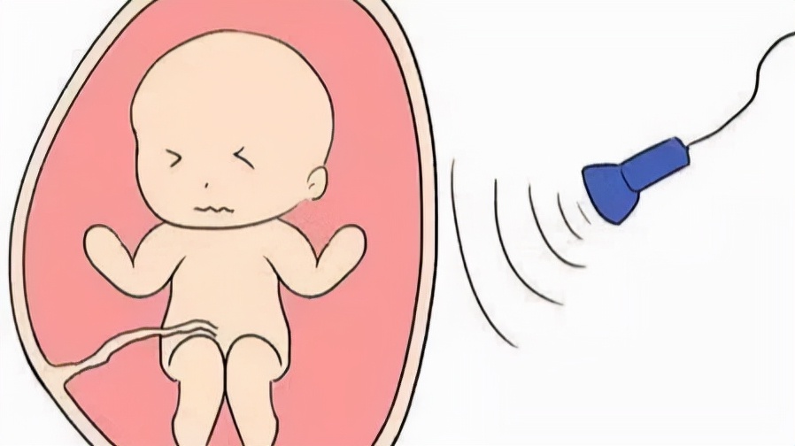 孕四月孕妇运动,孕期第四个月要做什么